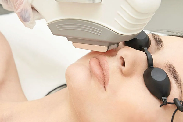IPL Hair Removal Lips nbw