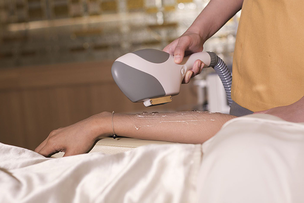 IPL Hair Removal nbw
